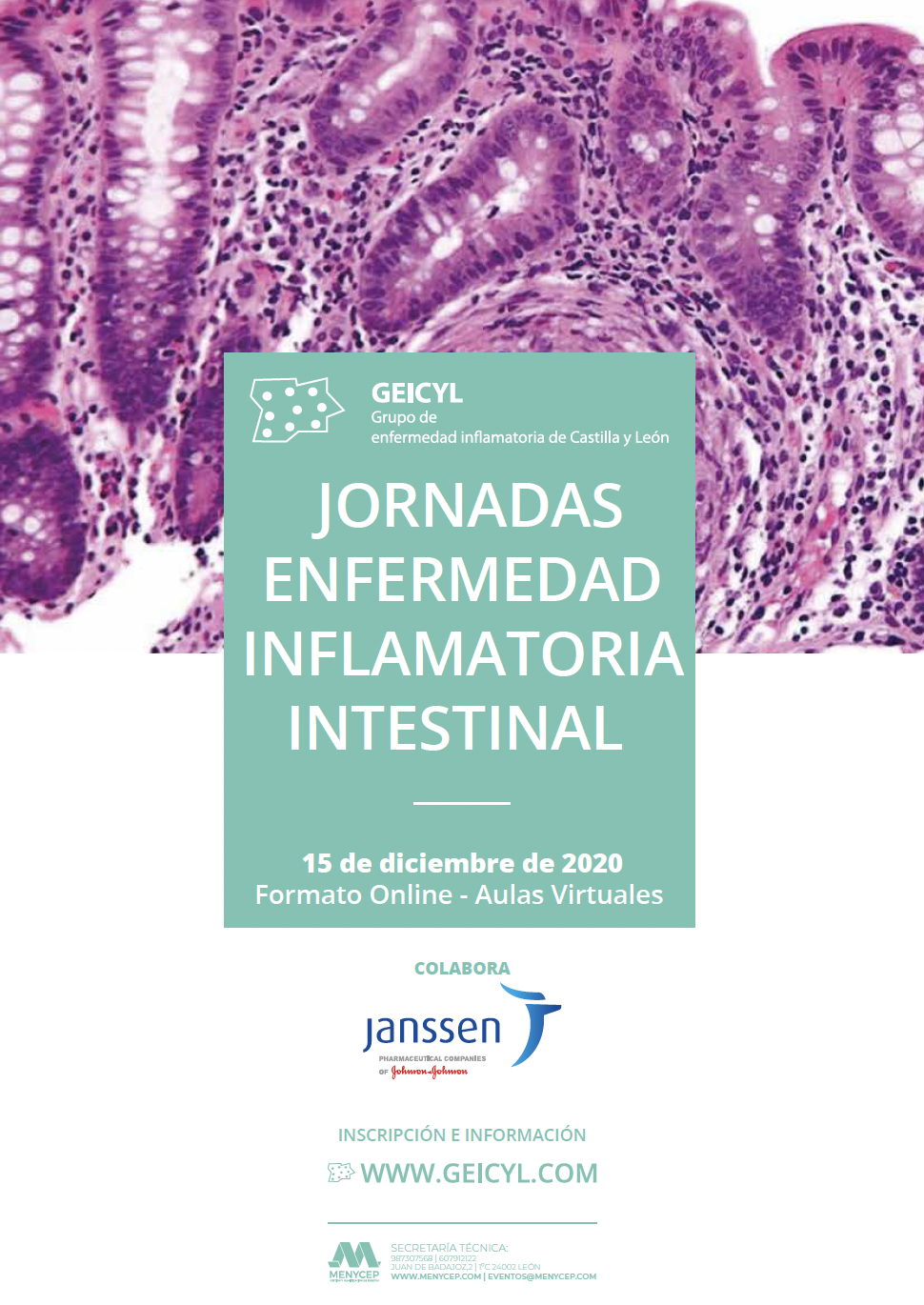 Jornadas de Enfermedad Inflamatoria Intestinal